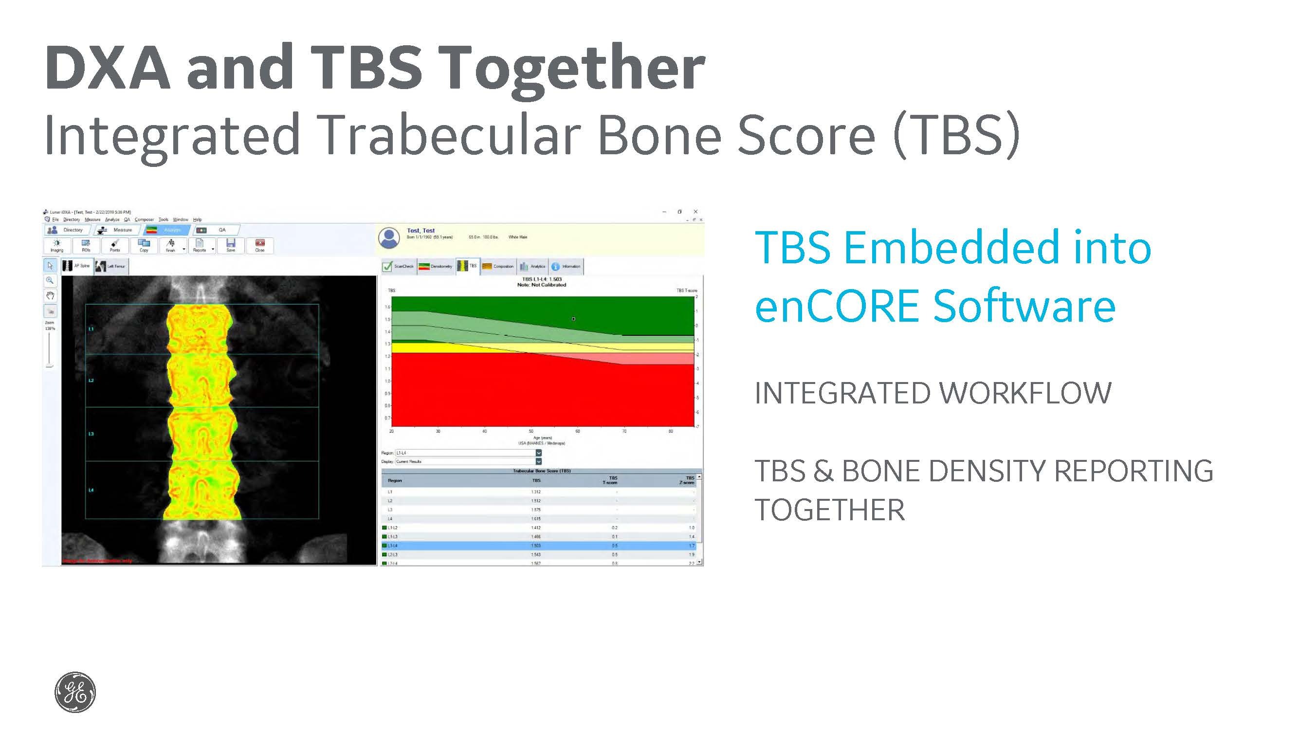 DXA Software with TBS Integration
