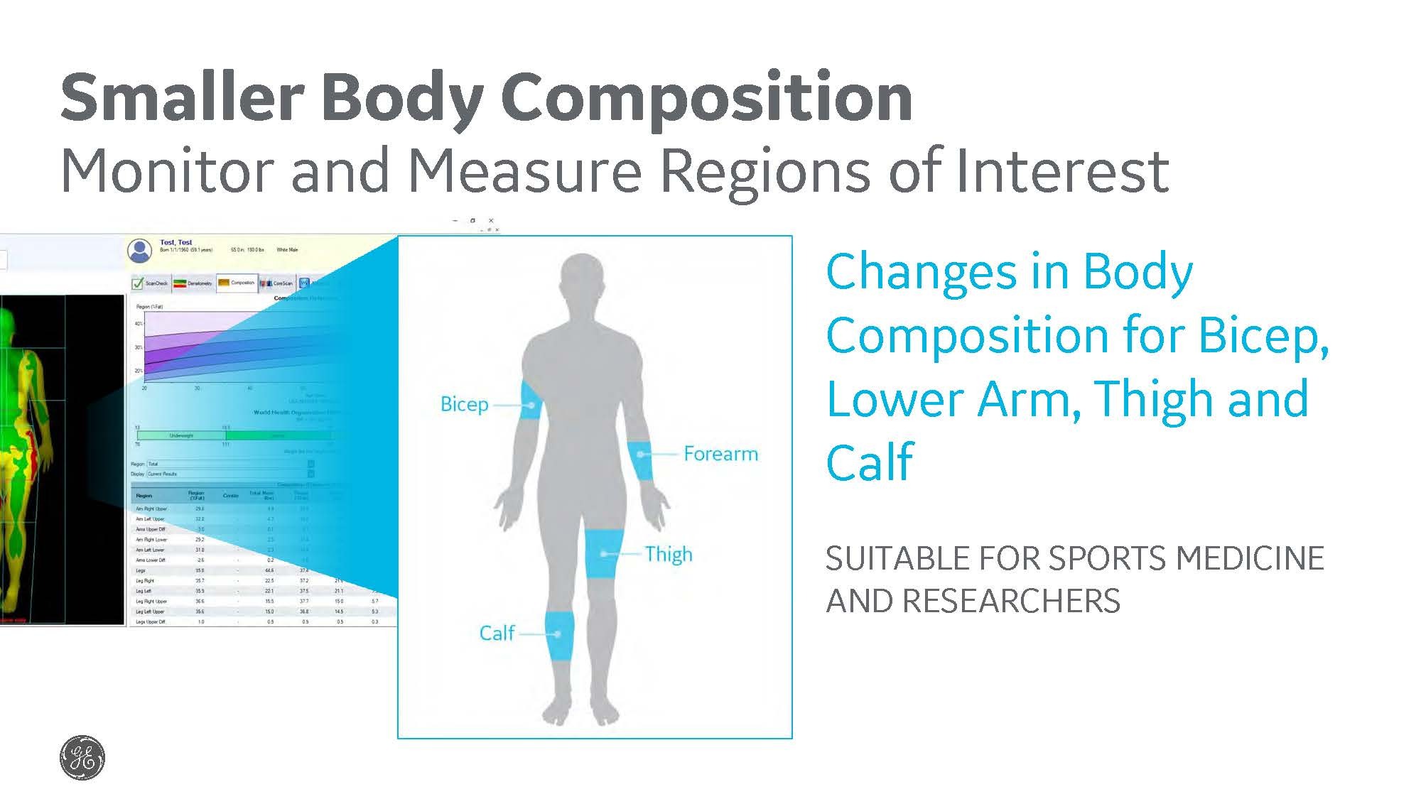 DXAVision for Body Comp Regions of Interest
